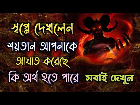 ভিডিও: স্বপ্ন কি আপনাকে আঘাত দিতে পারে?