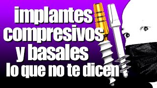 La MEJOR ATERNATIVA cuando NO TIENES HUESO para REEMPLAZAR DIENTES PERDIDOS de forma FIJA!