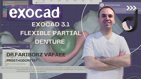 how to design flexible partial denture in exocad3.1rijka(part1)