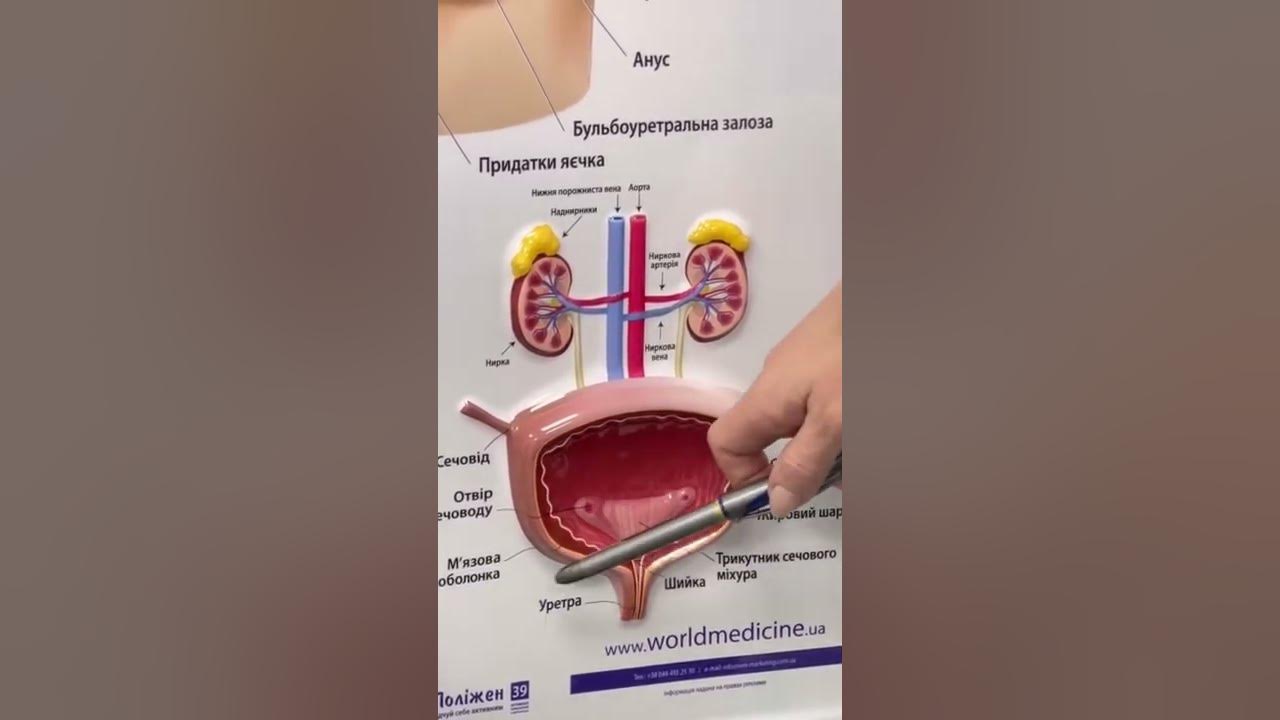 Частое мочеиспускание после тур. Тур мочевого пузыря техника операции.