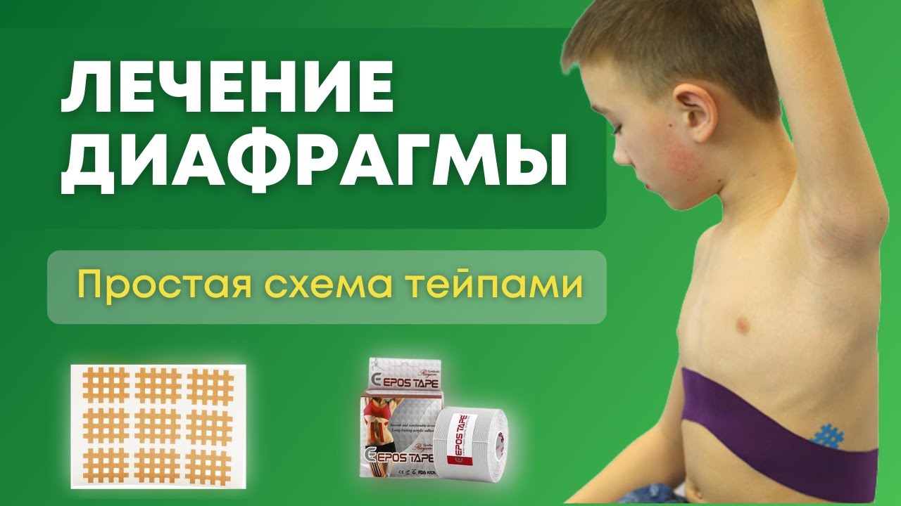 Как лечить диафрагму? Тейпирование в логопедии. Проста аппликация ...