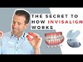 Invisalign 101 - How it works, behind the scenes, what an Orthodontist sees