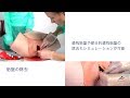 分娩後異常出血(PPH)への処置をトレーニングできます│P97