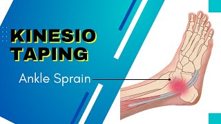 How to Apply kinesiology Tape for an Ankle Inversion Sprain