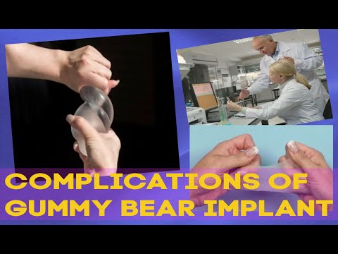 Video: Gummy Bear Implants: Pro Dan Kontra, Biaya, Kewaspadaan