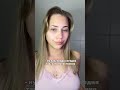 И так всегда…. УЗ