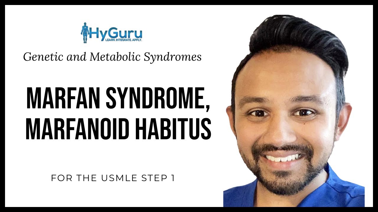 Marfanoid Syndrome Marfanoid Habitus High Yield Genetic And marfanoid-syndrome-marfanoid-habitus-high-yield-genetic-and