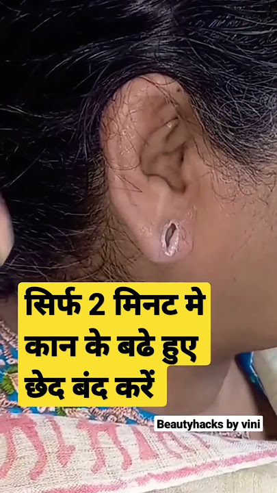 Ear pasting #earloberepair #shorts #beautyhacksbyvini #trending #viral #yt20