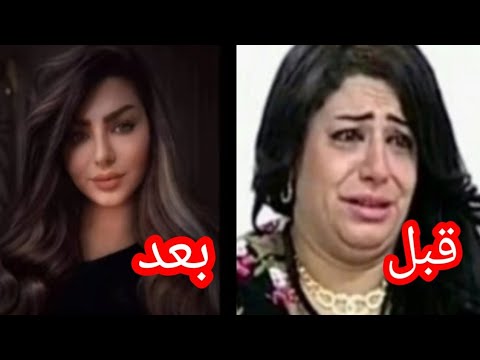 تمارا جمال قبل وبعد عمليات التجميل