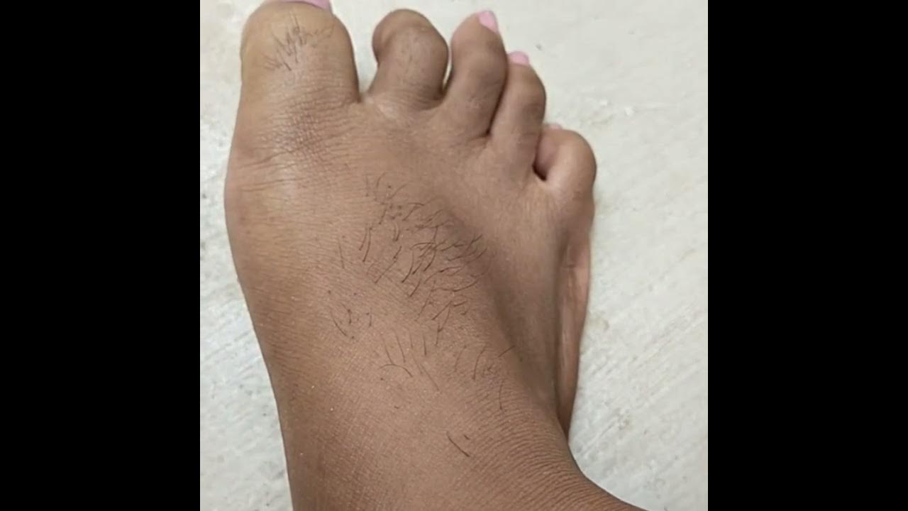 most effective feet and toe hair removal from root at home using