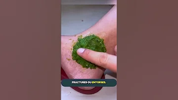 Si Vous Voyez Cette Plante Simple Au Bord Des Champs Ou De La Forêt Regardez La Attentivement 