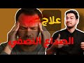 علاج الصداع النصفي أفضل طرق لعلاج الصداع النصفي أعراض الصداع النصفي Migraine