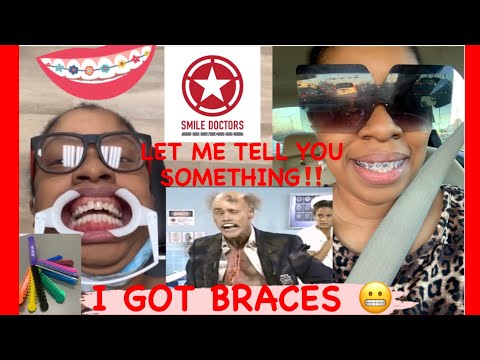 LET ME TELL YOU SOMETHING! | I got Braces ? | Smile Doctors Vlog Thursday, January 13, 2022❤️