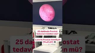 Is It Possible to Treat an Enlarged Prostate in Just 25 Minutes?Laser Prostate Surgery (ThuFLEP)