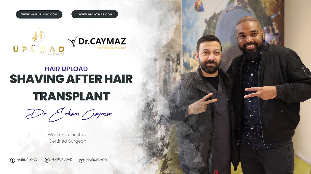 Shaving after hair transplant