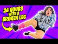 24 HOURS WITH A BROKEN LEG!!!