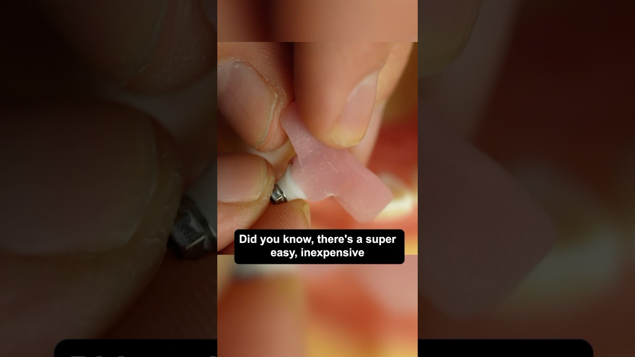 The Abutment Seating Jig! Who else uses these? 