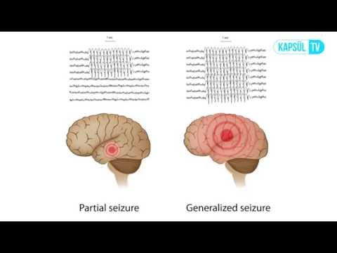 Elektroensefalografi (EEG) Nasıl Çekilir?