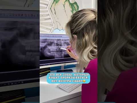 На приёме у Стоматолога-Ортодонта! #shorts