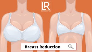 Breast Reduction | Dr. Leif Rogers | Beverly Hills | LRMD