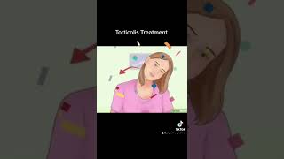 تشنج عضلات الرقبة | Torticolis Treatment review