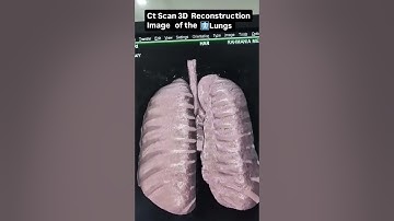 Ct Scan 3D Reconstruction Image of the 🫁 lungs#viralvideo#youtubeshorts #online #science #tranding