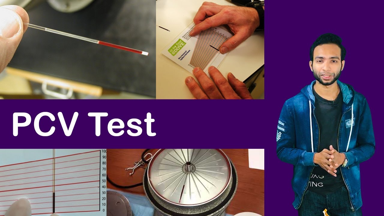 Packed Cell Volume Test ( PCV Test ) YouTube