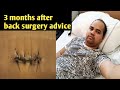 Microdiscectomy after 3 month Post spine surgery advice, L4L5S1.in hindi (हिन्दी मैं)🙏