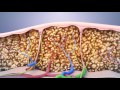 UltraShape Power: Fat Reduction in Orlando