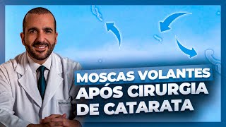 Moscas Volantes após Cirurgia de Catarata - Dr. Gustavo Bonfadini