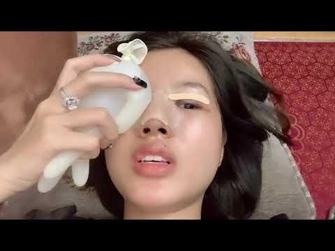 Video: Lần phẫu thuật thẩm mỹ đầu tiên của Lina - chỉnh sửa mũi