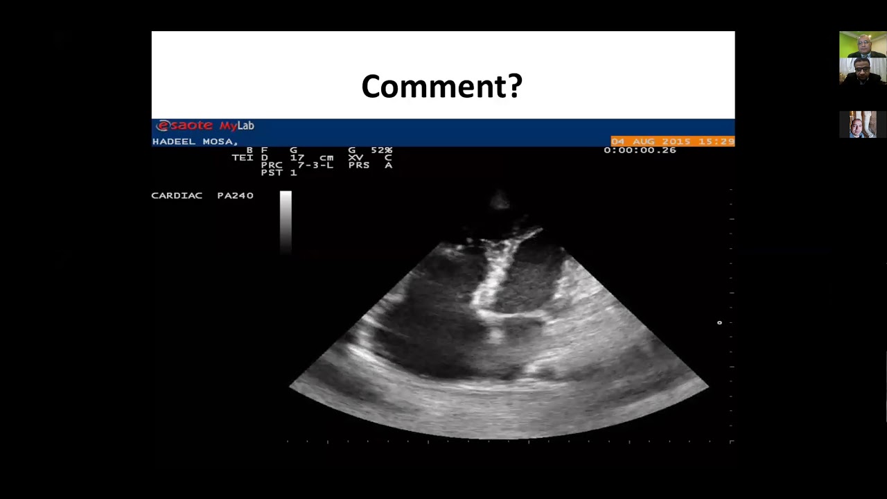 zoom tracing II, Taher saeed , Moustafa Mokarrab, Mohamed samy , Abd Elmohsen Moustafa