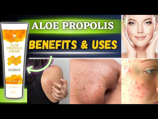Forever aloe propolis cream benefits| aloe propolis creme how to use |  forever living products | flp - YouTube