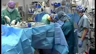 Global News Story Dr Sanjiv Gandhi Pediatric Heart Surgeon