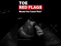 Transoesophageal echocardiography | Red Flags You CANNOT Miss
