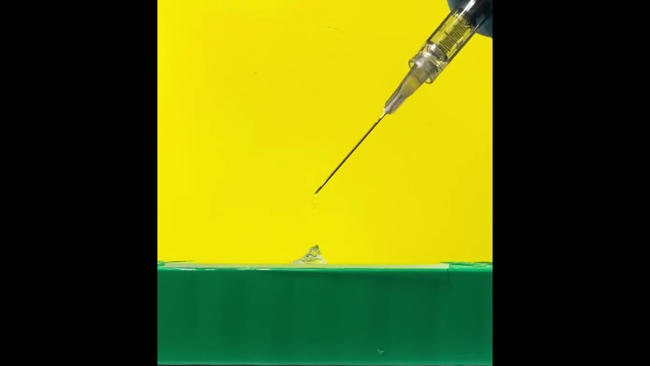 Injectable hydrogel -22g needle