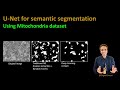 204 - U-Net for semantic segmentation of mitochondria