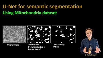 204 - U-Net for semantic segmentation of mitochondria