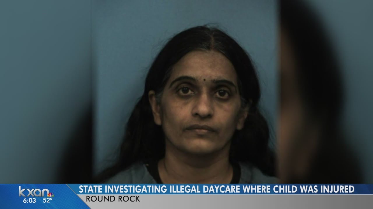 Child badly hurt at illegal day care
