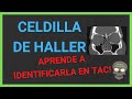 CELDILLA DE HALLER (tomografía)✅