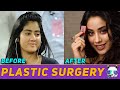 Plastic Surgery से पहले और बाद की बॉलीवुड अभिनेत्रियाँ | Actresses Before and After Plastic Surgery