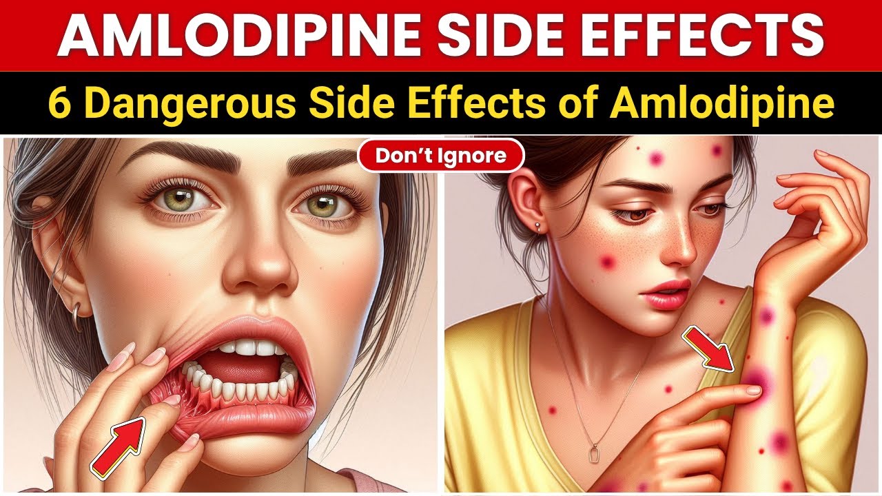 6 опасных побочных эффектов амлодипина, которые НИКОГДА нельзя игнорировать!