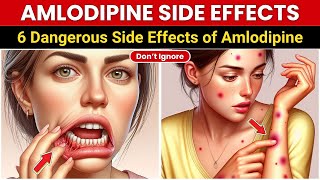 6 Dangerous Side Effects of Amlodipine You Should NEVER Ignore!