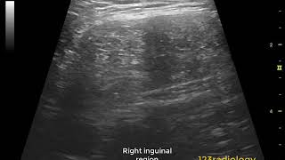 Ultrasound Case 02