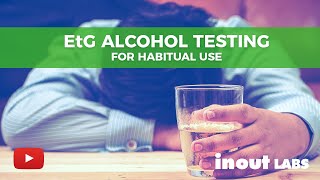 EtG Alcohol Testing for Habitual Use