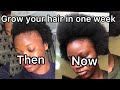 ONION JUICE FOR VIRGIN HAIR GROWTH | Result in 7 days