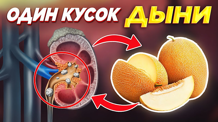 Даже один КУСОК ДЫНИ, может вызвать НЕОБРАТИМЫЙ ПРОЦЕСС (Секретный метод хранить ДЫНЮ на зиму)