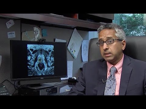 Prostate screening guidelines?