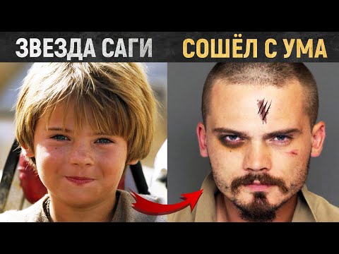 Как Звёздные Войны СЛОМАЛИ ЖИЗНЬ актёру Энакина (Страшная болезнь)