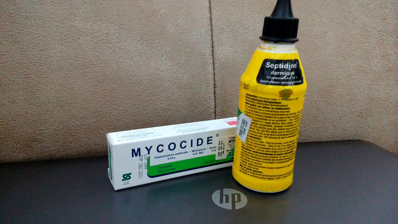 علاج إنتفاخ و تورم أصابع الطيور من لسعات الحشرات و الفطريات